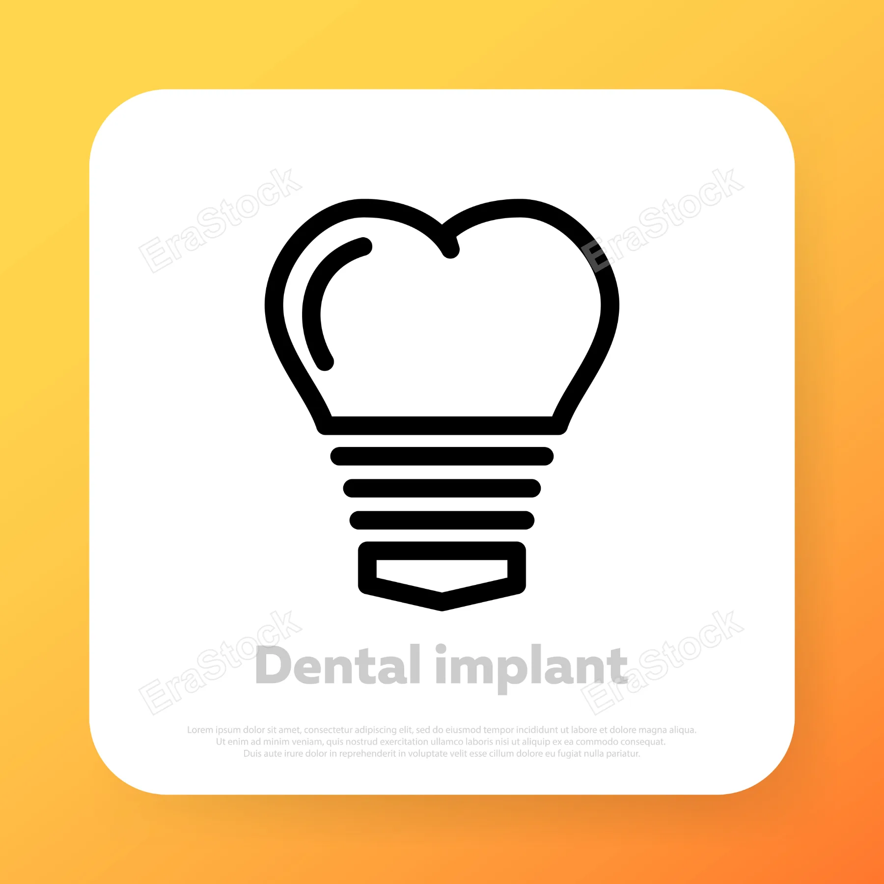 Dental implant icon. Teeth implantation. Stomatology clinic. Vector line icon for Business and Advertising.